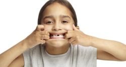 Những dấu hiệu cần chỉnh nha cho trẻ