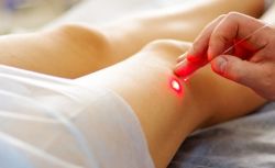 Cơ chế của các phương pháp điều trị tĩnh mạch