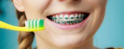 7 lưu ý khi đánh răng trong giai đoạn đeo niềng