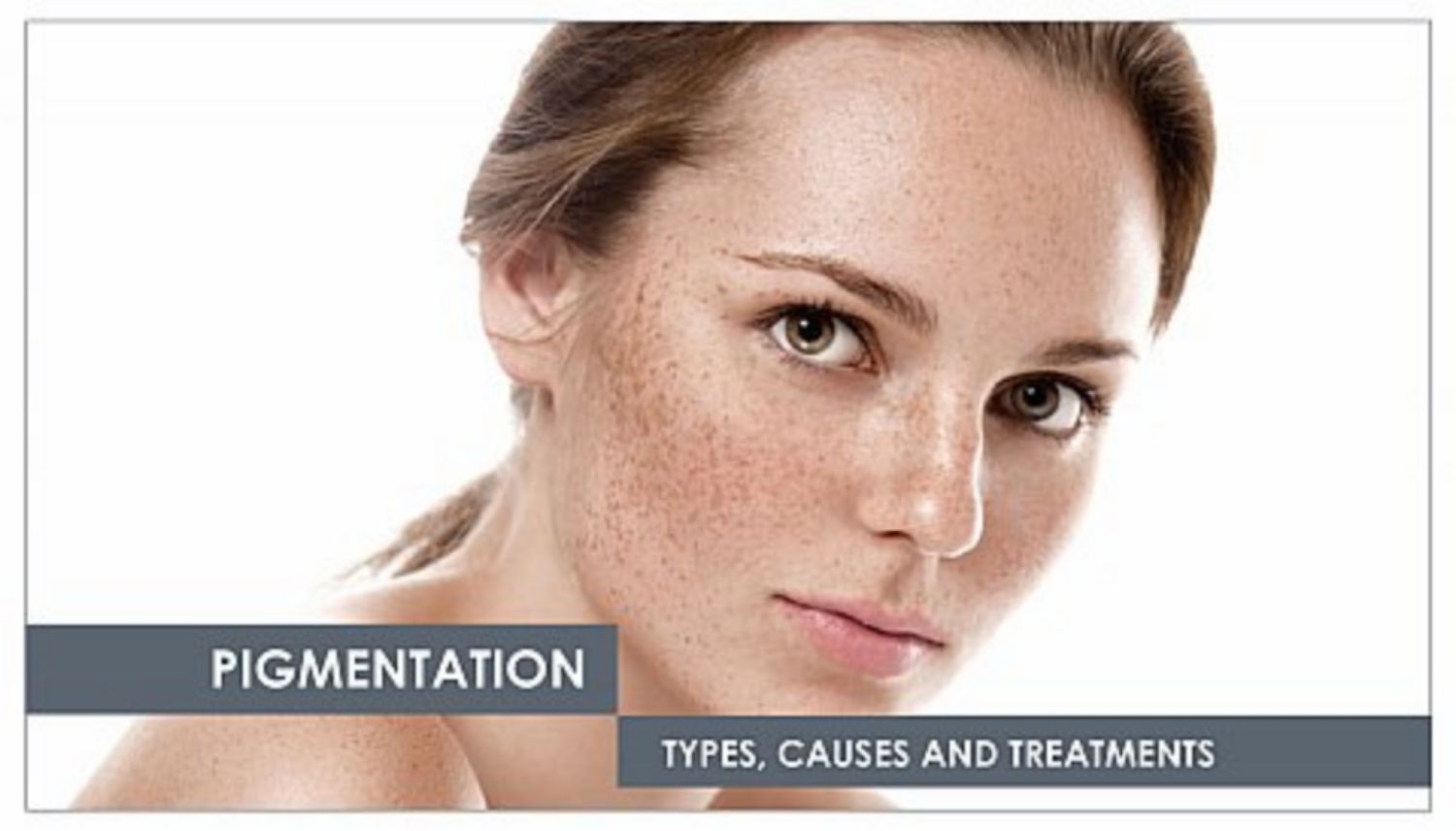 Da nhiễm sắc tố và các thuật ngữ liên quan