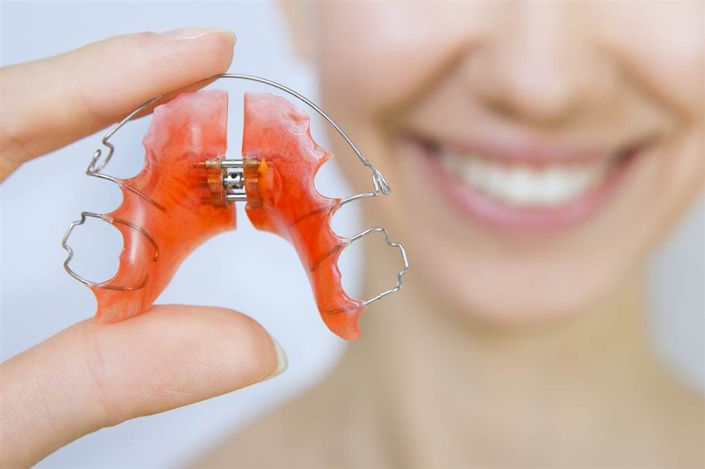 Cách duy trì hàm răng thẳng đều sau khi tháo niềng