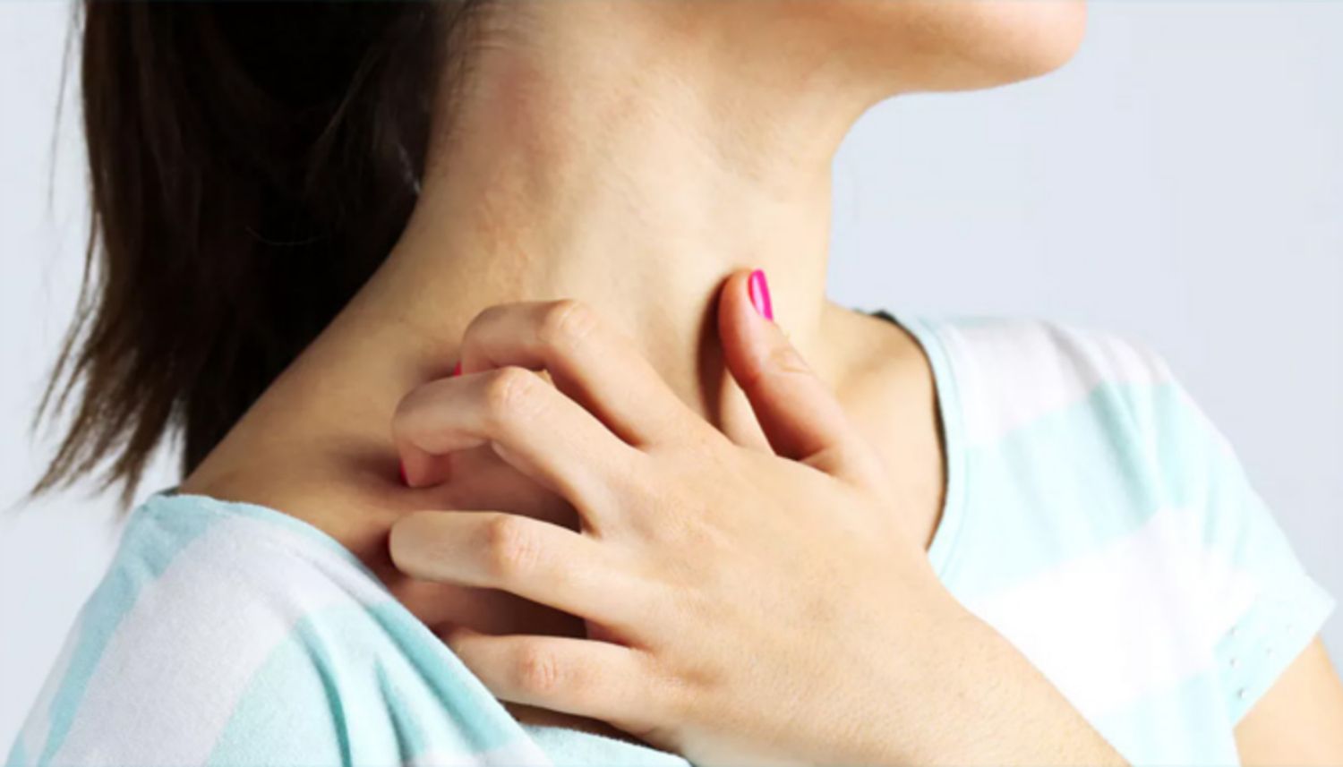 Các yếu tố môi trường ảnh hưởng đến viêm da cơ địa như thế nào?