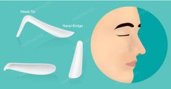 Silicone và Goretex, nên chọn loại vật liệu nào để nâng mũi?