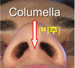 Trụ mũi: các vấn đề thường gặp và cách khắc phục