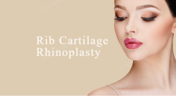 Nâng Mũi Cấu Trúc Bằng Sụn Sườn