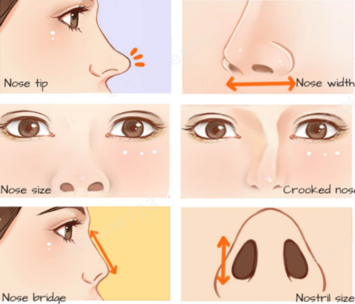 Các biến chứng có thể gặp phải sau nâng mũi bằng sụn tự thân