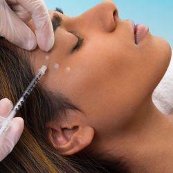 Các vấn đề có thể gặp phải sau tiêm botox xóa nếp chân chim đuôi mắt