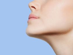 Hô, móm nên niềng răng hay phẫu thuật hàm