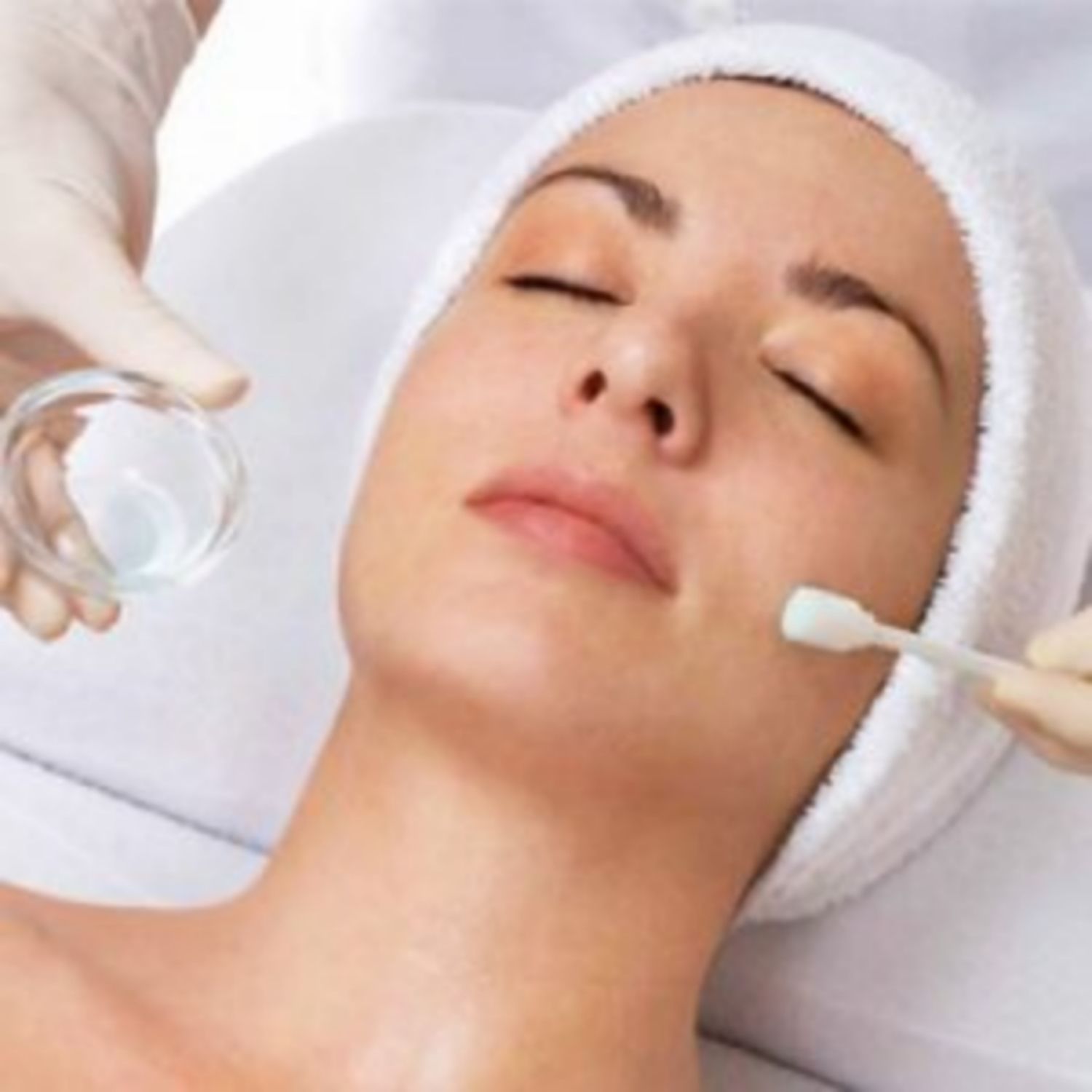 Da khỏe- phương pháp lột da hóa học peel giành cho bạn
