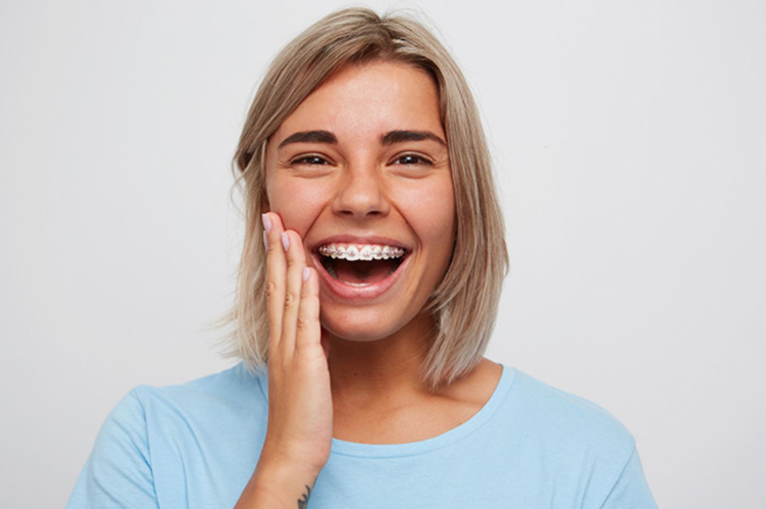 Phẫu thuật hàm hô móm: cần đeo niềng răng trong bao lâu?