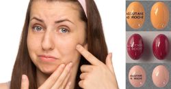 Tác dụng phụ của thuốc trị mụn Isotretinoin