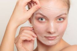 Tẩy da chết hóa học peel có giúp chữa mụn và sẹo không?