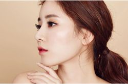 Phẫu thuật thu gọn góc hàm