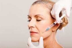 Khi nào nên bắt đầu tiêm Botox?
