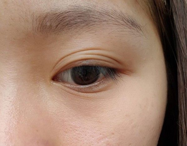 Lợi ích và cách chăm sóc mắt 3 mí để có đôi mắt sáng khỏe