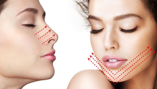 Điểm danh các phương pháp nâng mũi không phẫu thuật phổ biến