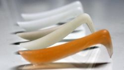 Sụn nhân tạo: sử dụng sao cho đúng?