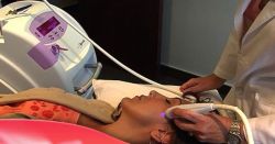 Trị sẹo mụn bằng công nghệ Plasma portrait