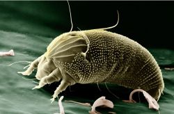 Bệnh trứng cá đỏ và kí sinh trùng Demodex