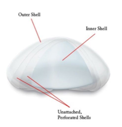 Túi độn ngực Ideal