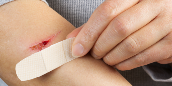 Cách xử lý vết cắt chảy máu trên da