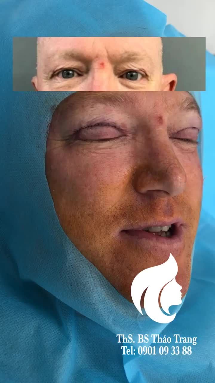 Anh ấy trẻ ra 10 tuổi rồi!