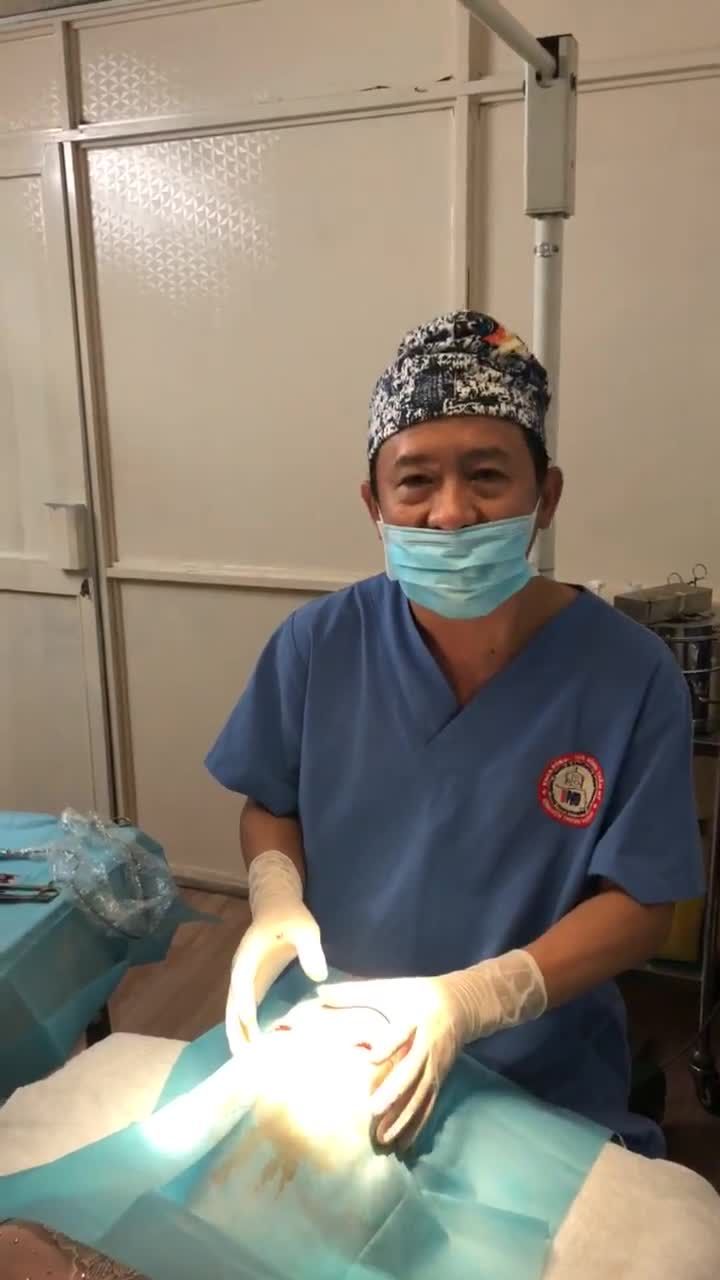 Cắt mắt mí đôi lấy mỡ, da thừa