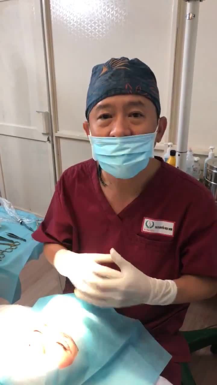 Cắt mí đôi lấy mỡ trên KH có mí lót, 2 mí không đều nhau.