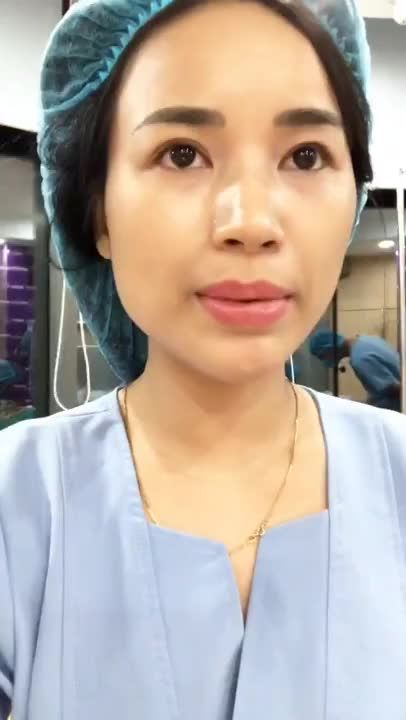Cắt mí mắt trên 1 bạn gái có mí mắt lót, mỡ mí nhiều