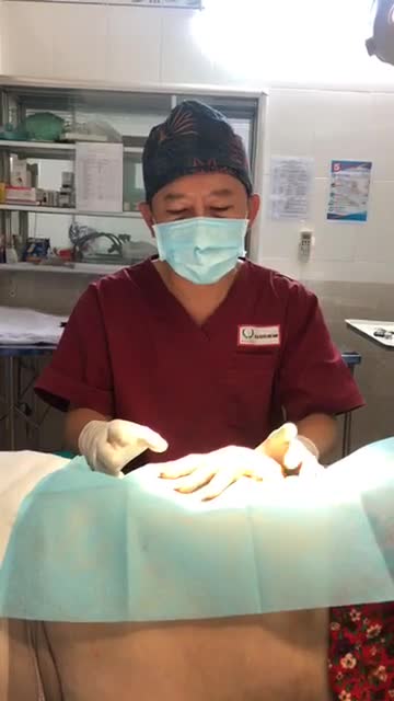 Chuyển mỡ lên mu bàn tay ở KH 55 tuổi