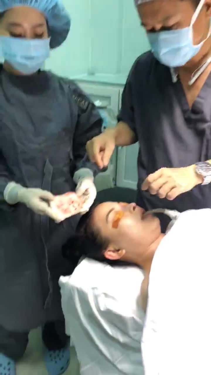 Chỉnh sửa mũi hỏng do tiêm filler
