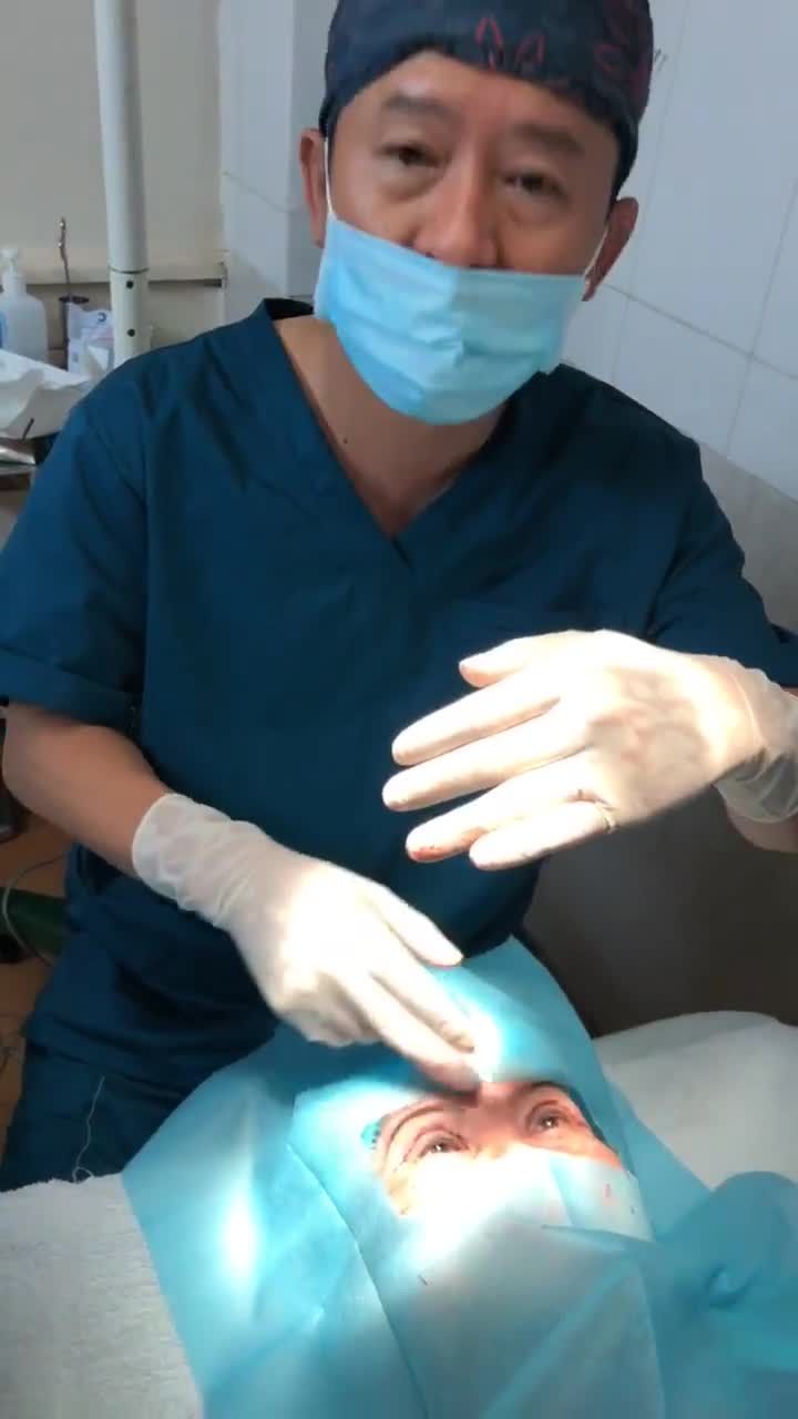 Kết quả cắt mí đôi lần 2 ở người lớn tuổi