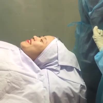 Phẫu thuật nâng mũi và giải đáp thắc mắc