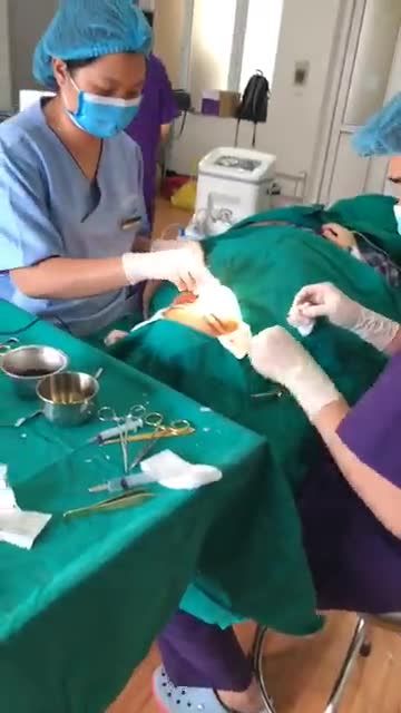 Nâng mũi S line khắc phục mũi to bè