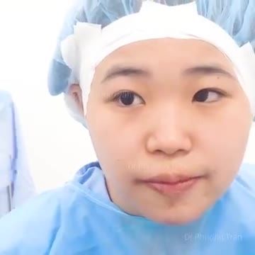 Chuẩn bị "biến hóa" chiếc mũi của 1 bạn du học sinh Nhật Bản