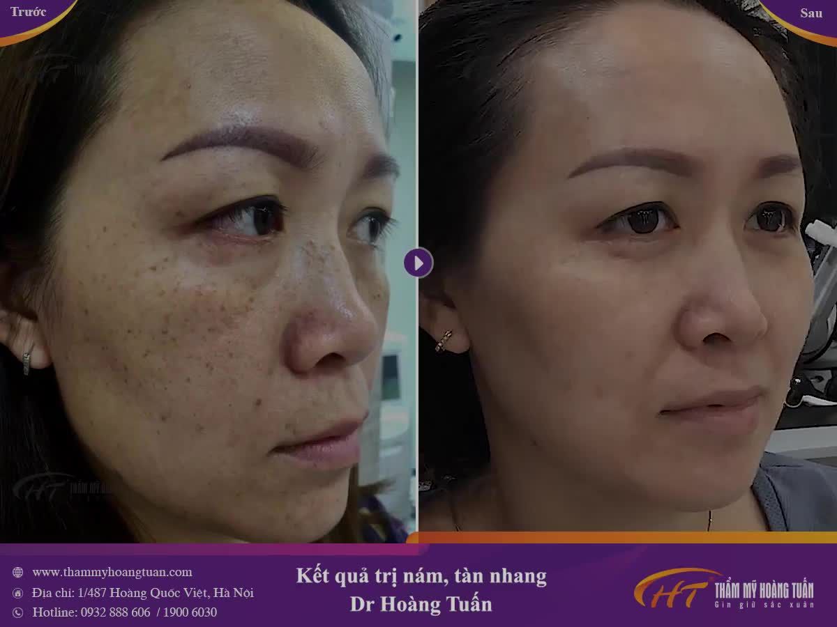 Sự cải thiện khá tuyệt vời