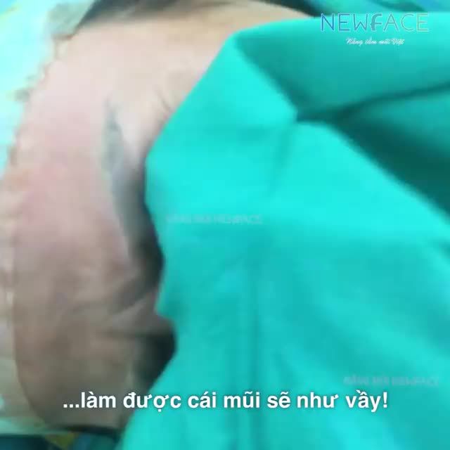 Hạnh phúc vỡ òa sau khi nhìn thấy dáng mũi