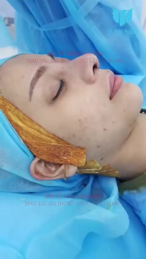 May quá! Đã cứu được chiếc mũi của bạn ấy!