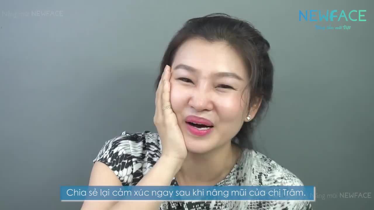 Nâng mũi đẹp không tưởng