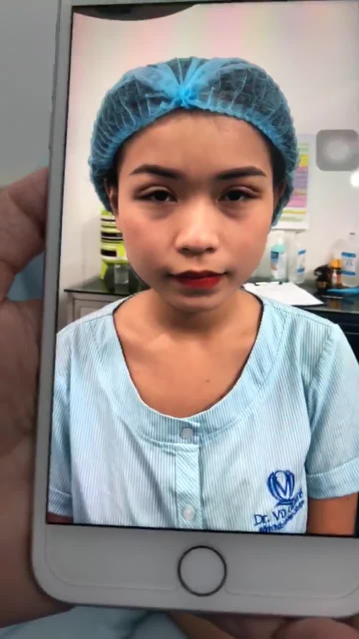 Tạo hình mũi Softline