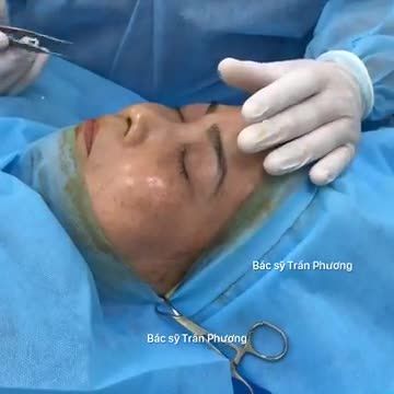 Phân tích trước Phẫu thuật nâng mũi