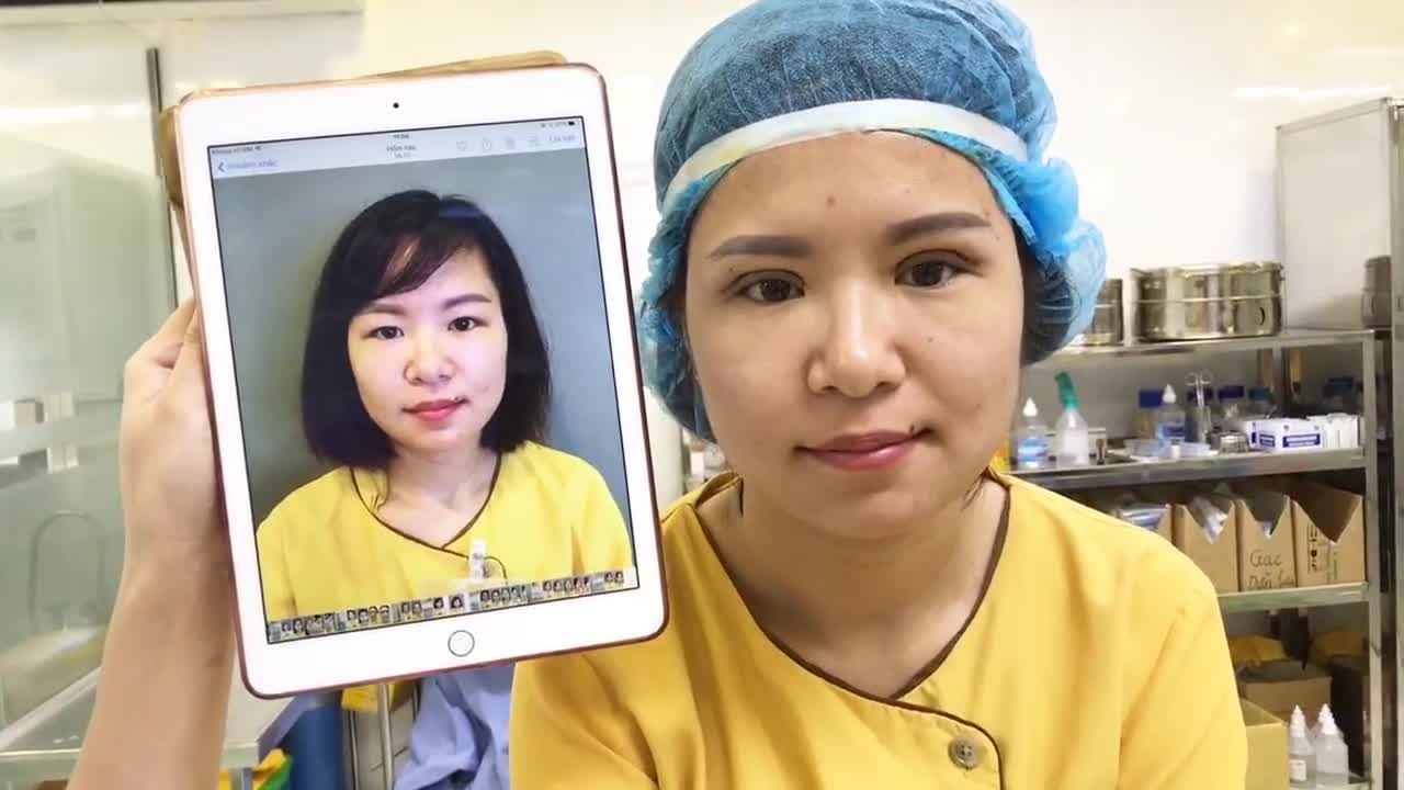 Cắt mí Double Deep 5D