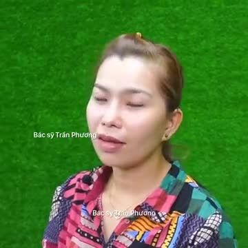 Dáng mũi sau 2.5 tháng nâng mũi cấu trúc sụn sườn tại thẩm mỹ viện Newface