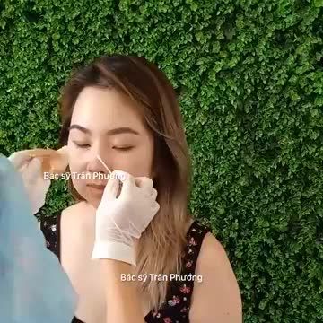 Tháo nẹp sau 7 ngày nâng mũi sụn sườn tự thân trên KH đến từ Mỹ