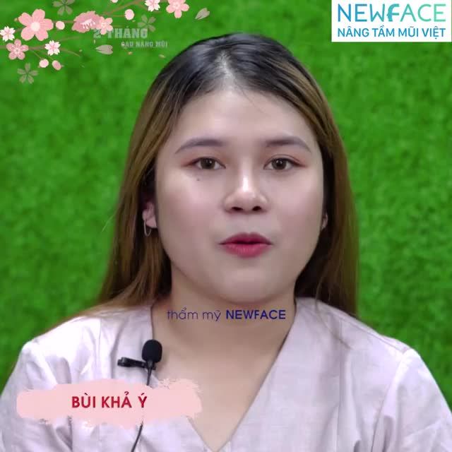 Gặp lại Khả Ý trong ngày tái khám sau 2 tháng nâng mũi