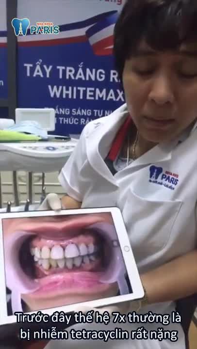 Bọc răng sứ thẩm mỹ Emax Zic tại Nha khoa Paris