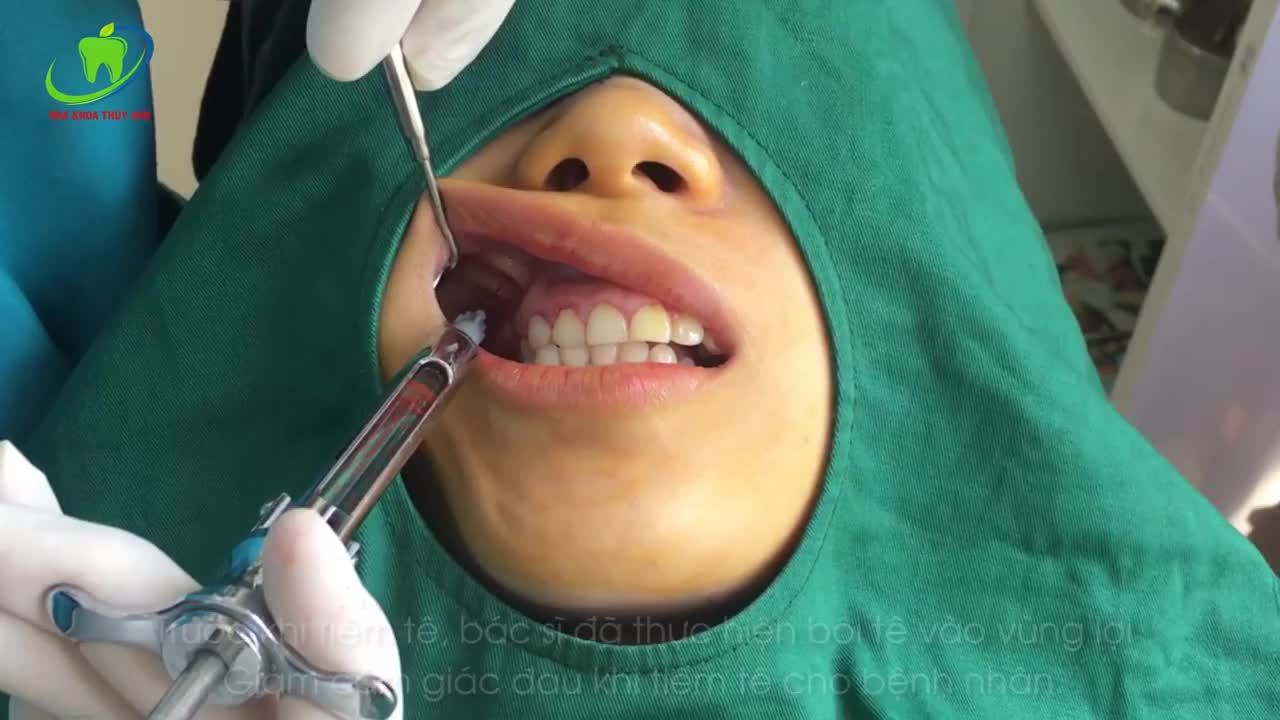 Procedure Show - Quy Trình Phẫu Thuật Cười Hở Lợi (Gummy Smile)