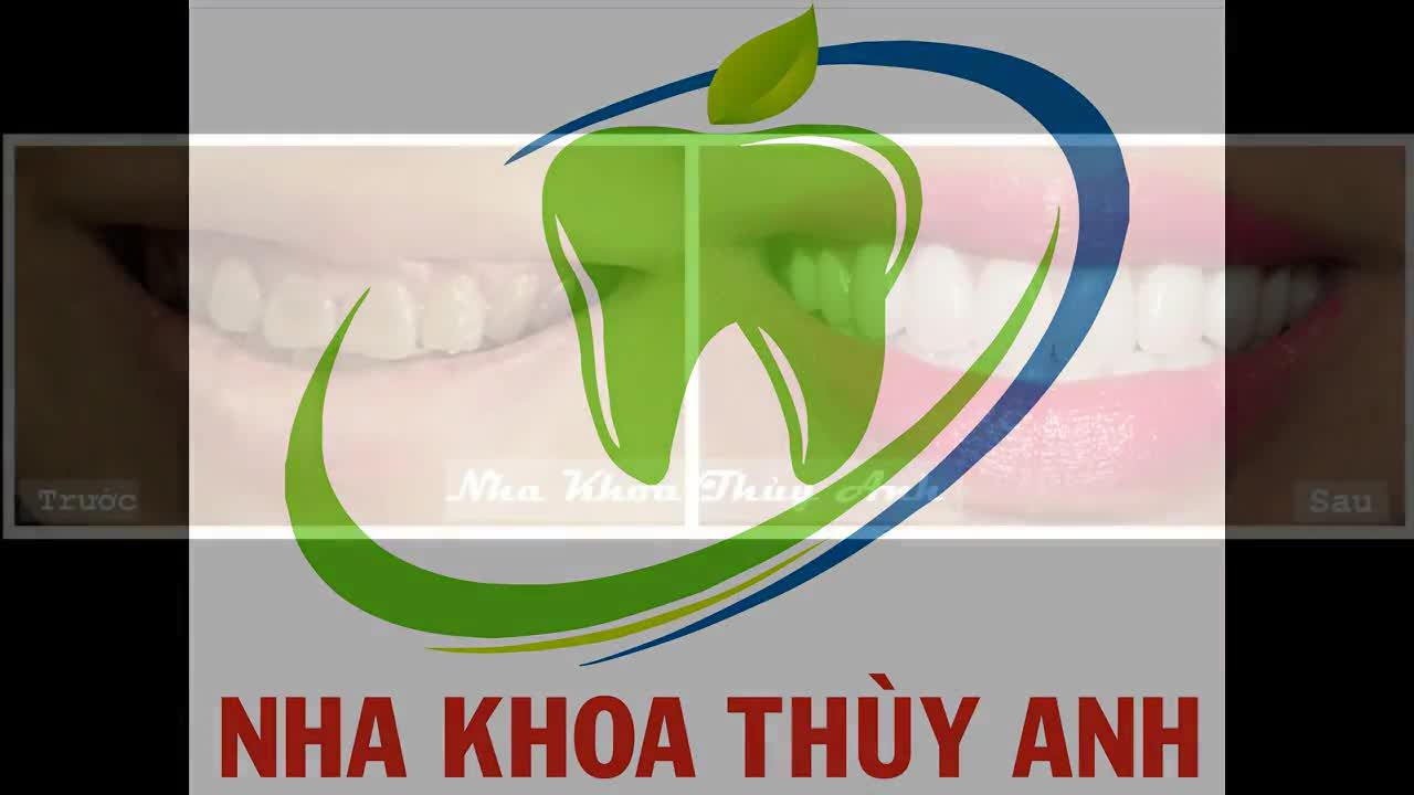 Răng Sứ Thẩm Mỹ - Nha Khoa Thùy Anh