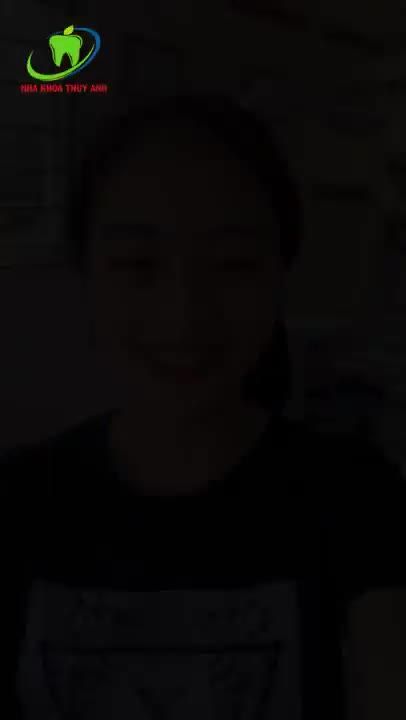 Tự tin với nụ cười khi Niềng răng