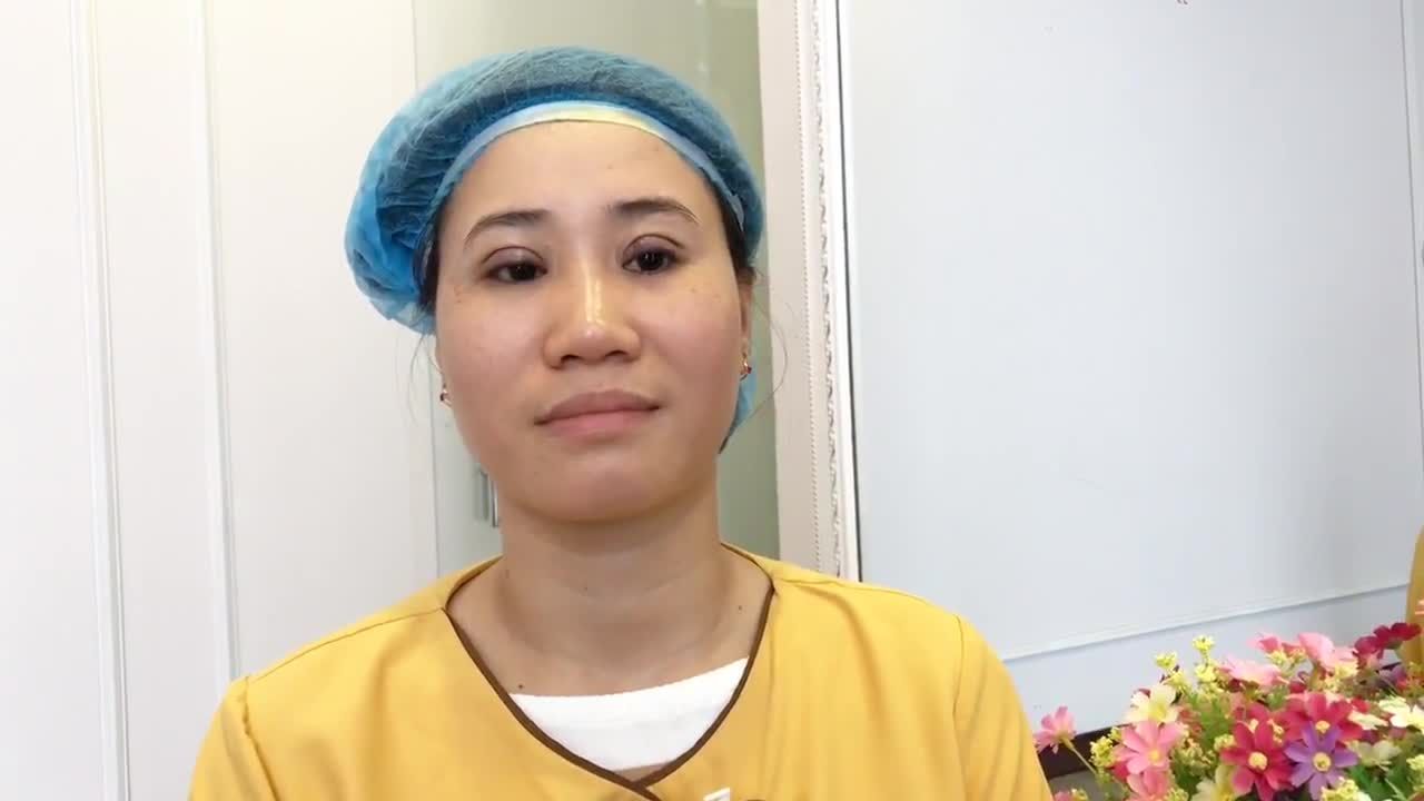 Chiêm Ngưỡng Đôi Mắt 2 Mí Vừa Cắt Mí Xong Tại VTM Dr Hải Lê - Ca 79